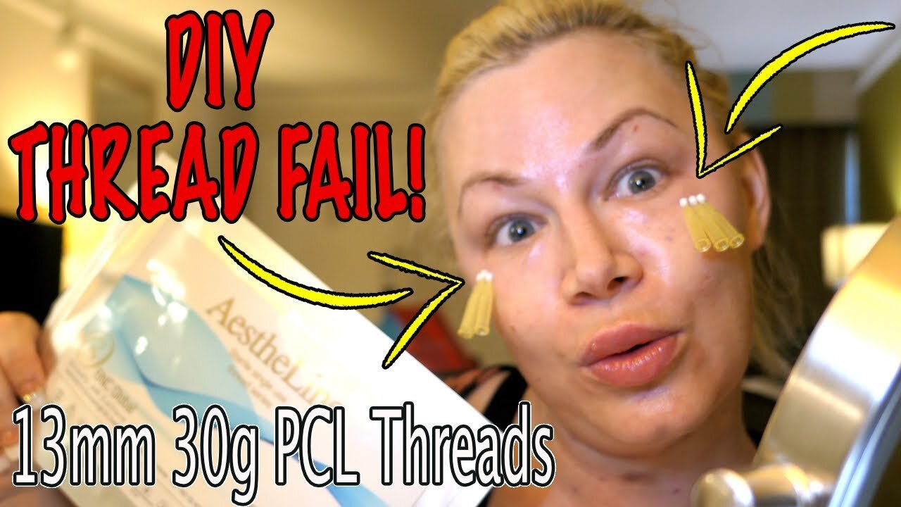 Thread FAIL 13mm 30g PCL threads in my Eyes | Code Jessica10 saves you $$$