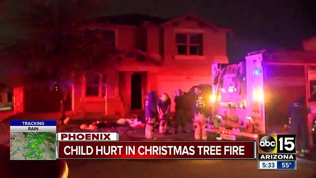 Boy burned in Phoenix house fire