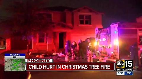 Boy burned in Phoenix house fire