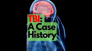 Where The Head Meets The Road