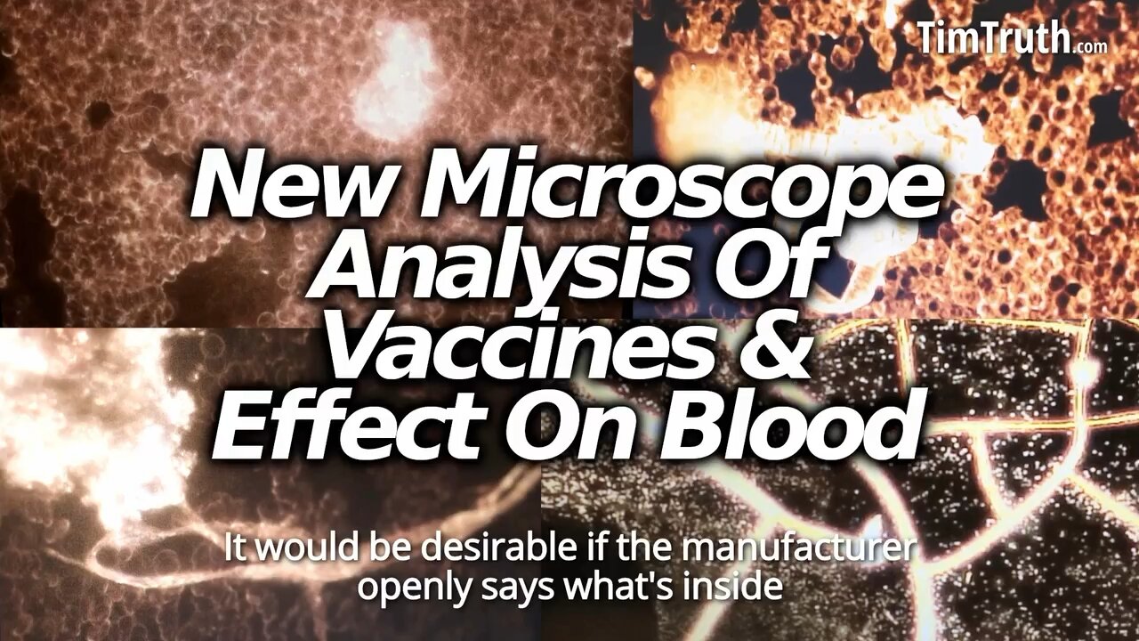 German scientists analyze inoculated blood