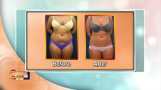 Gentle And Easy Lipo With Swan Centers