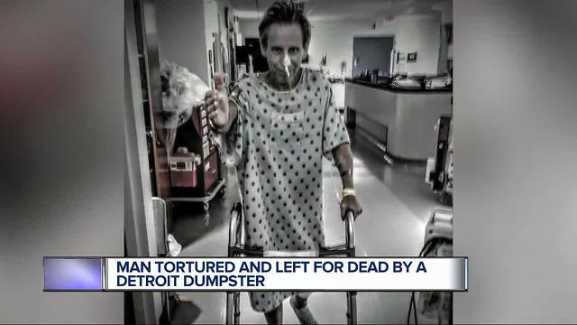 Man who was beaten and left for dead says people walked by as he needed help