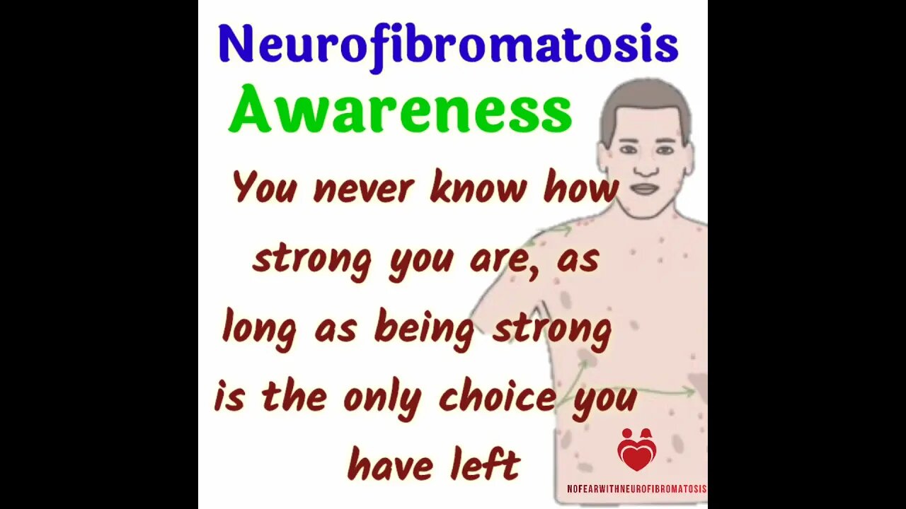 neurofibromatosis Awarnes || neurofibromatosis motivational #ytshorts #neurofibromatosistype1