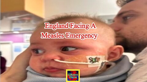 England facing a measles emergency as cases surge