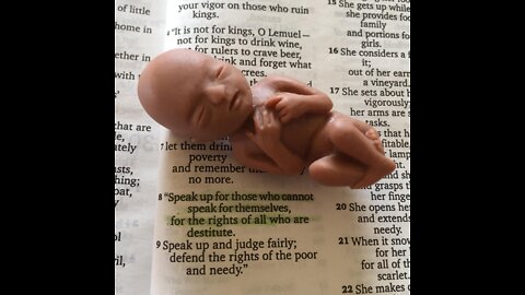 A fetus is a human being!