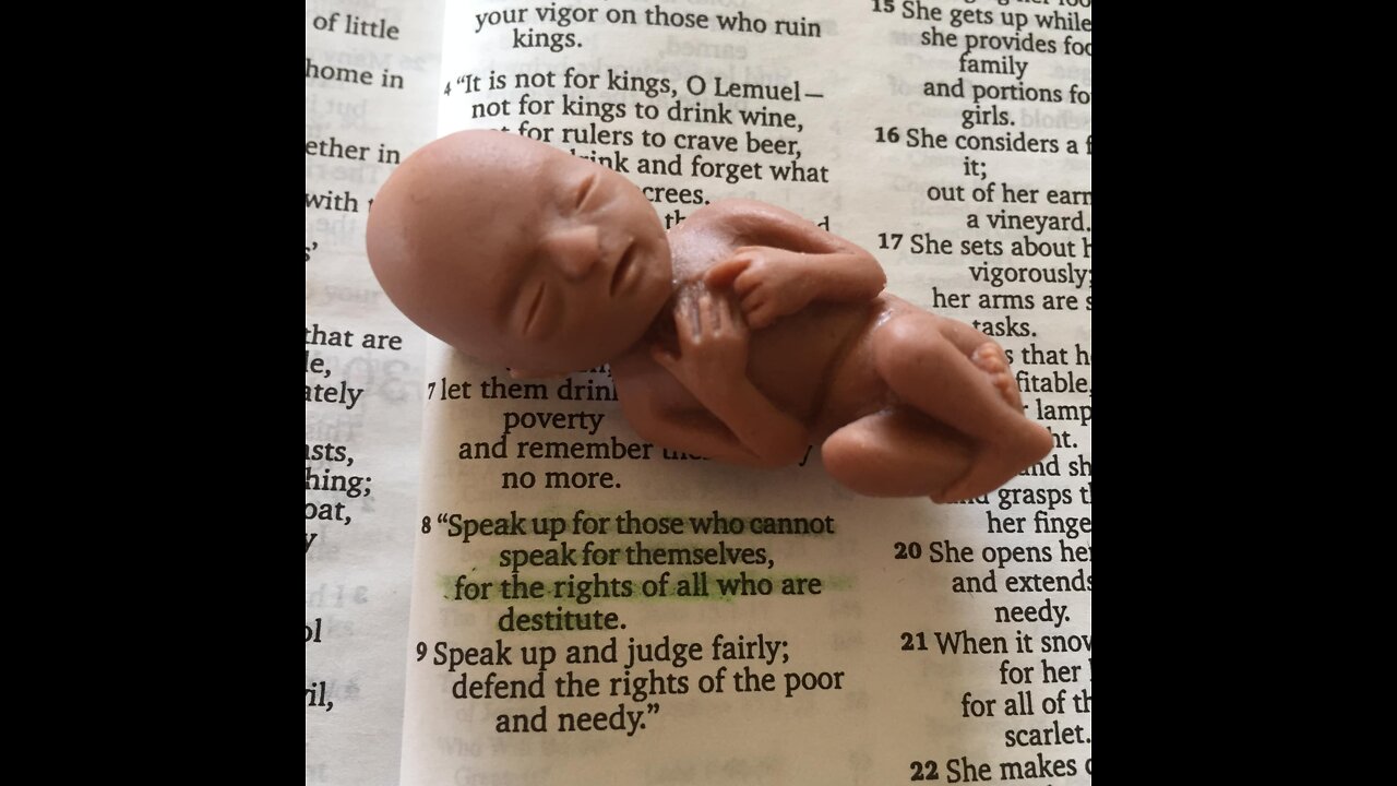 A fetus is a human being!