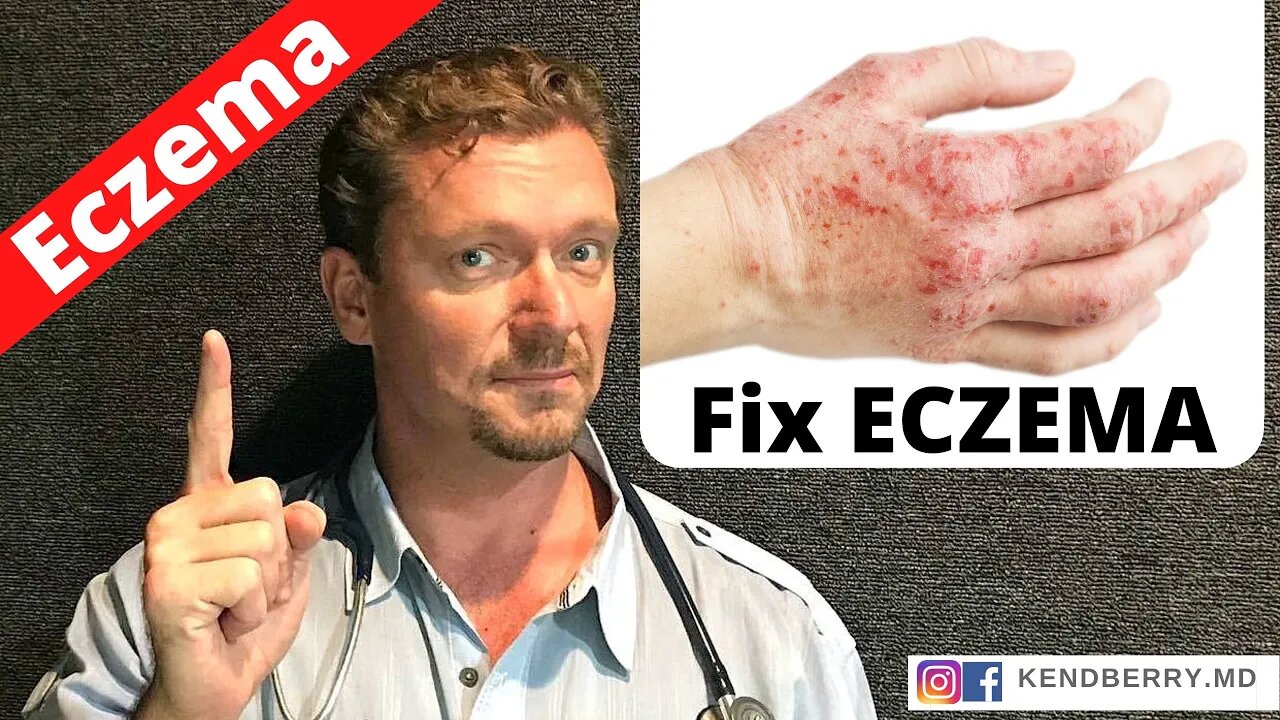 Is this Causing Your ECZEMA? (Easy Way to Tell) 2021
