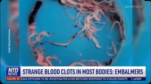 ALERT! Growing In The Bodies Of The V@Xxed!?!