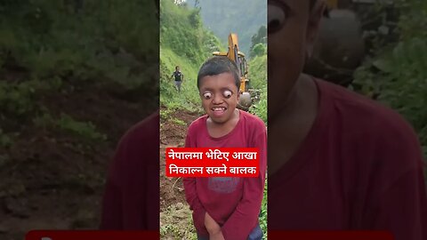 नेपालमा भेटिए आखा निकाल्न सक्ने बालक#shorts #tranding #youtubeshorts #viral #ytshorts #viralvideo