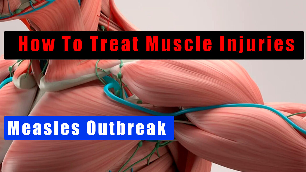 How To Treat Muscle Strains And A Bit on Measles