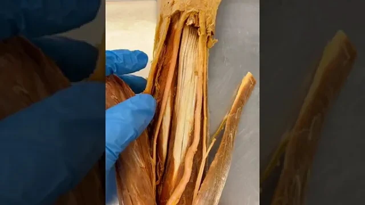 Inside a REAL Human Wrist
