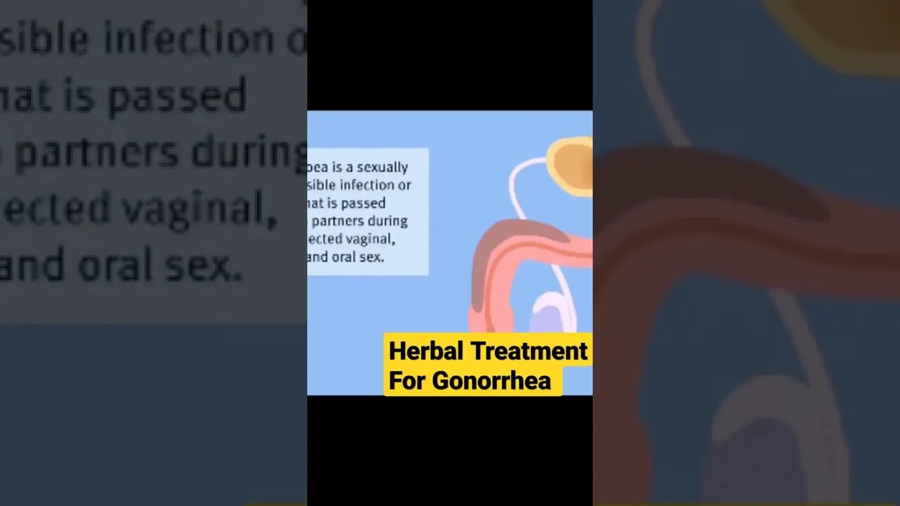 GONORRHEA MALE/FAMALE. herbal medicine kill gonorrhea in just 14 days use Dr Etiko herbs