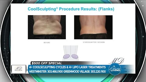 Struggling To Get Rid Of Fat Deposits? Get Sculpted! // MD Body & Medspa