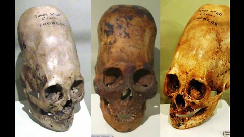 Paracas Elongated Skulls Of Peru - The DNA Results