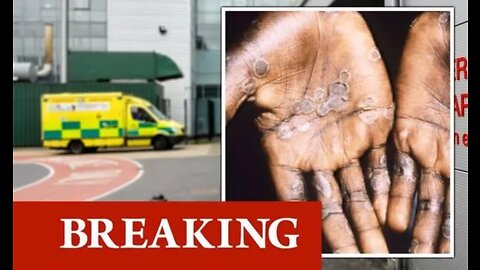 Monkeypox warning: 'Rare virus' confirmed in UK - seven deadly symptoms to watch out for