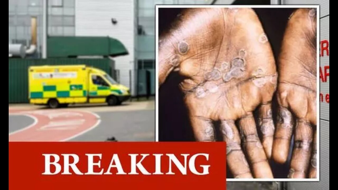 Monkeypox warning: 'Rare virus' confirmed in UK - seven deadly symptoms to watch out for