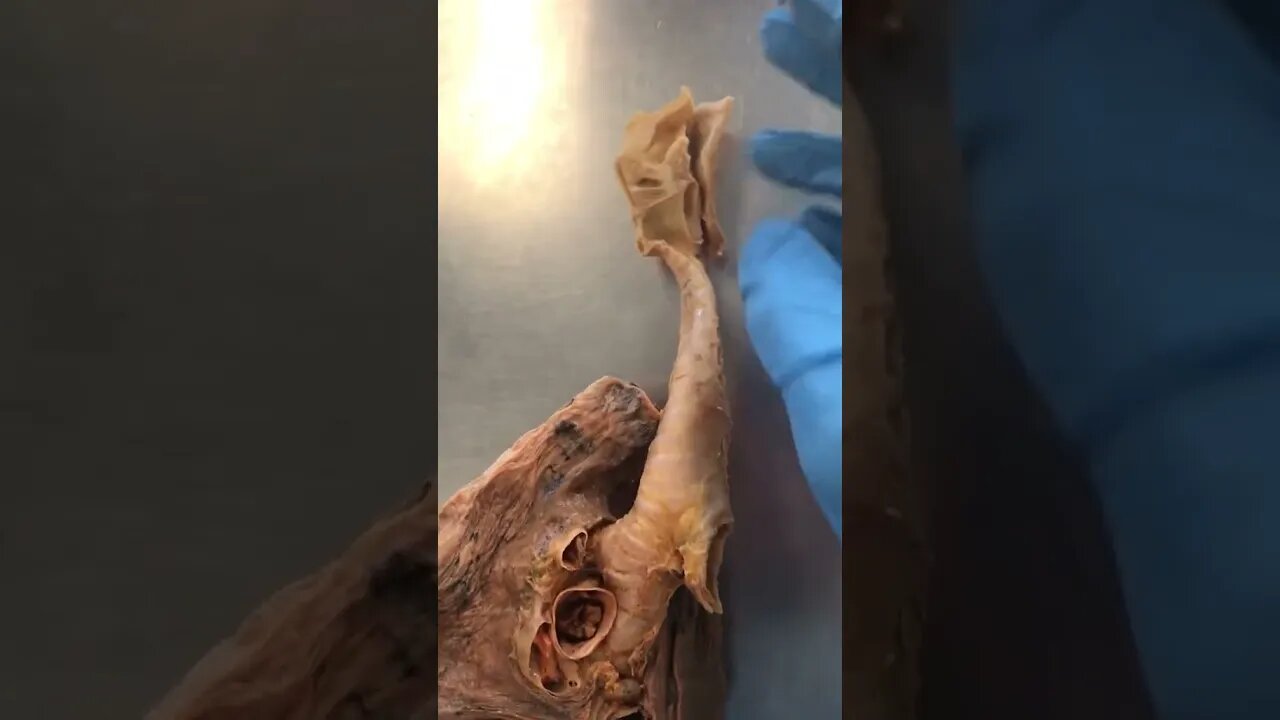 The Inside of a Human "Windpipe"