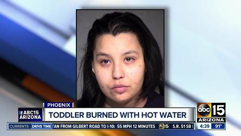 Police: Phoenix infant scalded on hand, step-mom arrested