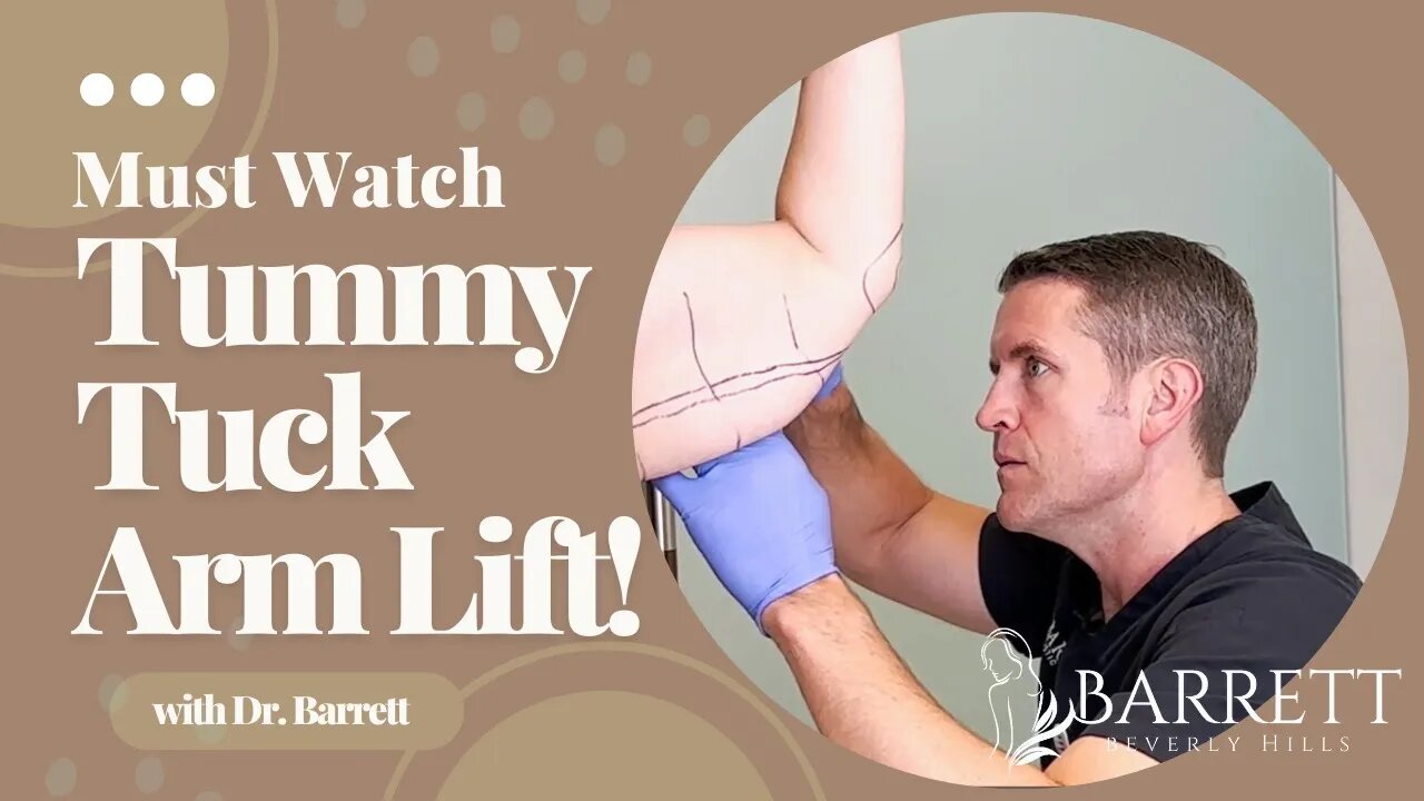 Amazing Arm Lift And Tummy Tuck! | Barrett Plastic Surgery