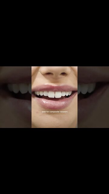 Dental And Teeth Hygiene