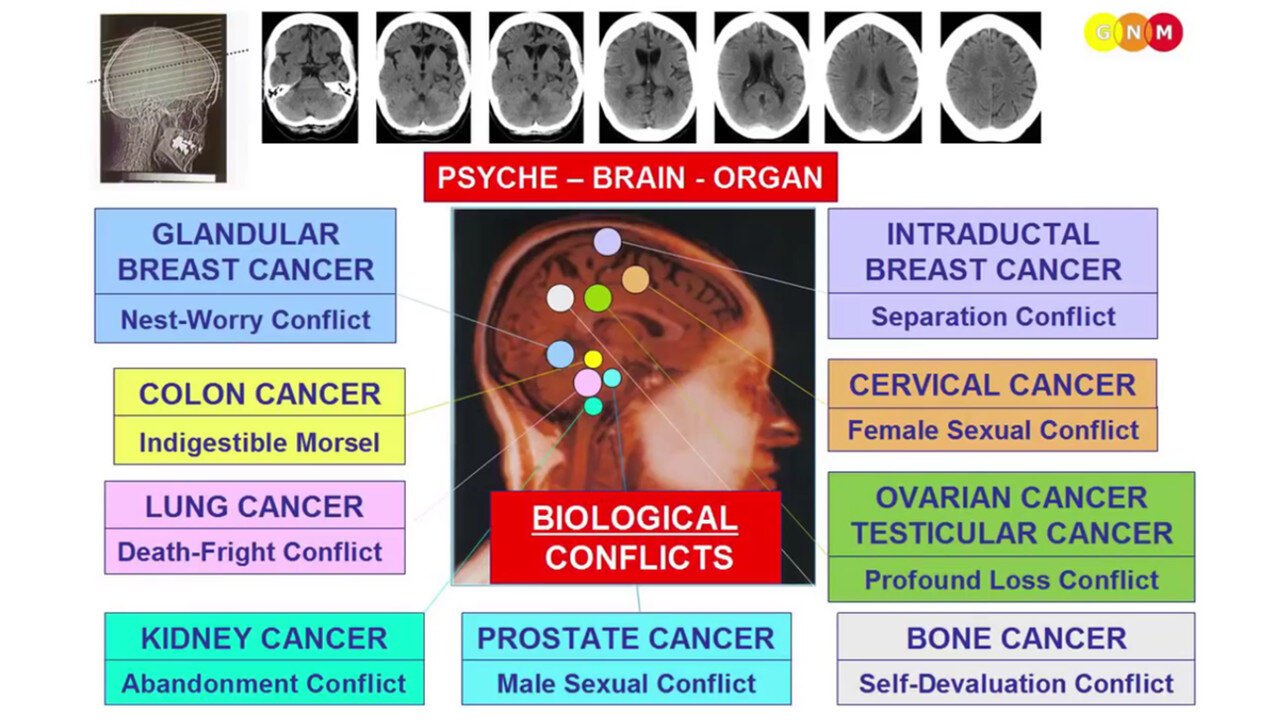 RICHPLANET Show 280: Dr. Ryke Geerd Hamer and the Psychological Link of Cancer