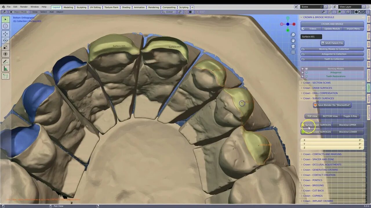 B4D Dental Modules