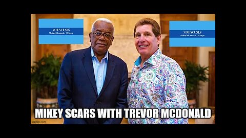 Mikey Scars Speaks For The First Time With Trevor McDonald 2015