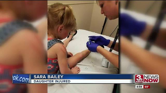 Girl scratched by falling iguana at Henry Doorly Zoo