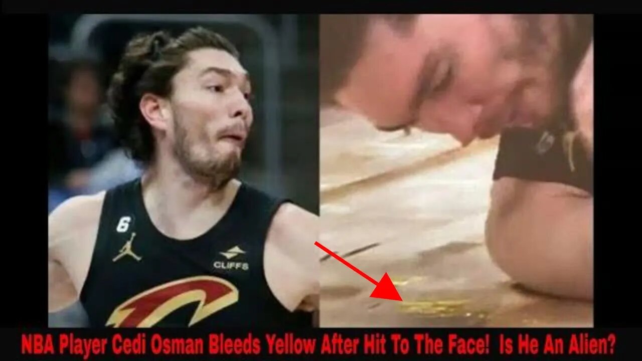 NBA Player Cedi Osman Bleeds Yellow After Hit To The Face! Is He An Alien?