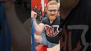 Chance Shaw has a vulnerable wrist