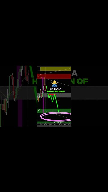 This Mistake will SAVE you Money in Trading.. 💸