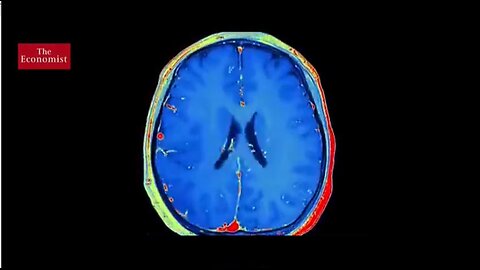 Hidras como controlo da IA para controlo humano