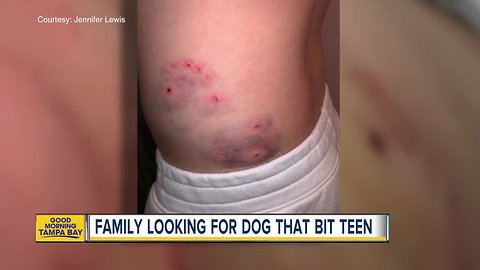 Teen hospitalized after dog bite in Palm Harbor