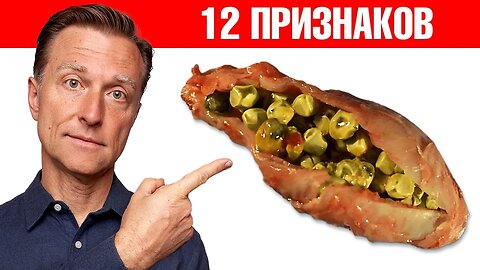 12 симптомов того, что желчный пузырь в опасности! Доктор Берг