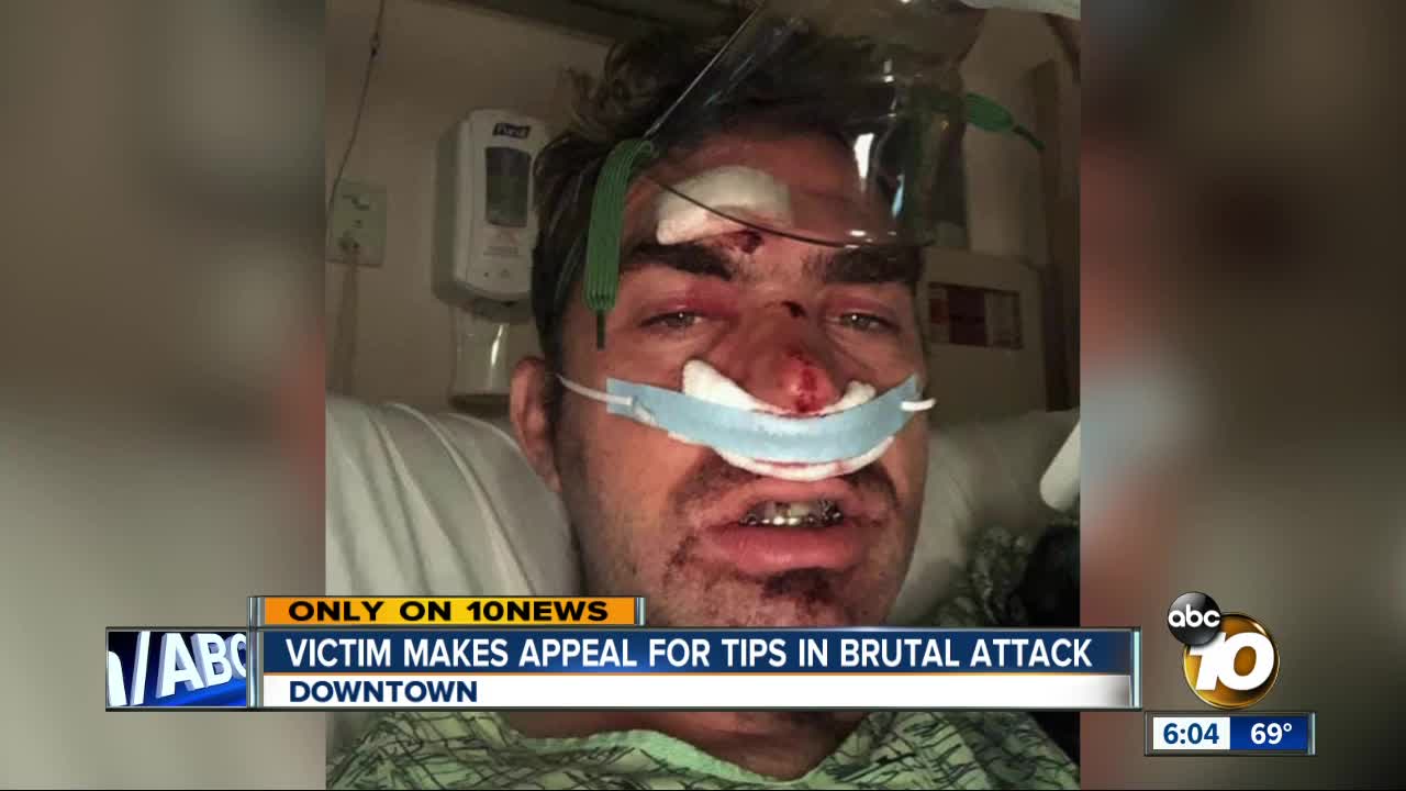 Victim makes appeal for tips in Gaslamp attack