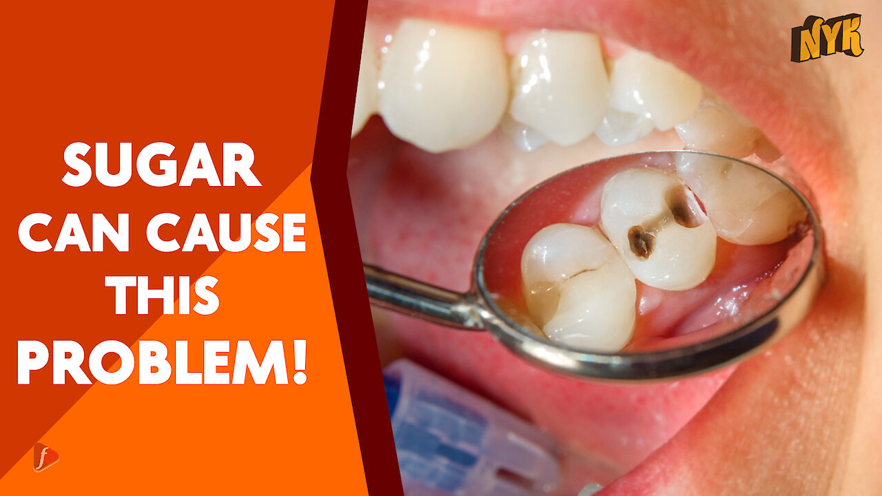 What Causes Cavity
