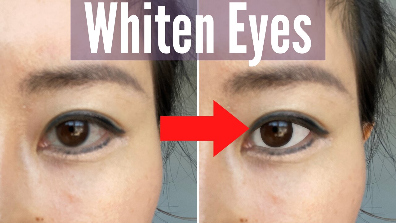 How to Whiten Eyes