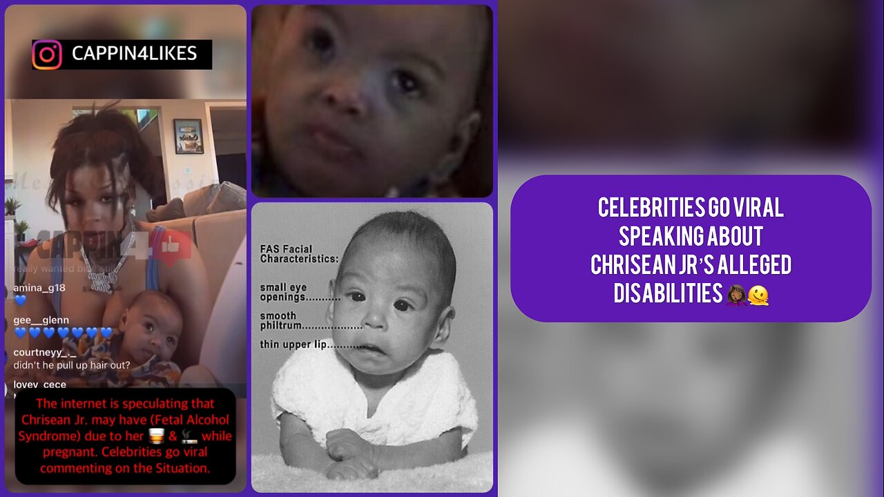 Celebrities Go Viral Speaking About CHRISEN JR’s Alleged Disabilities