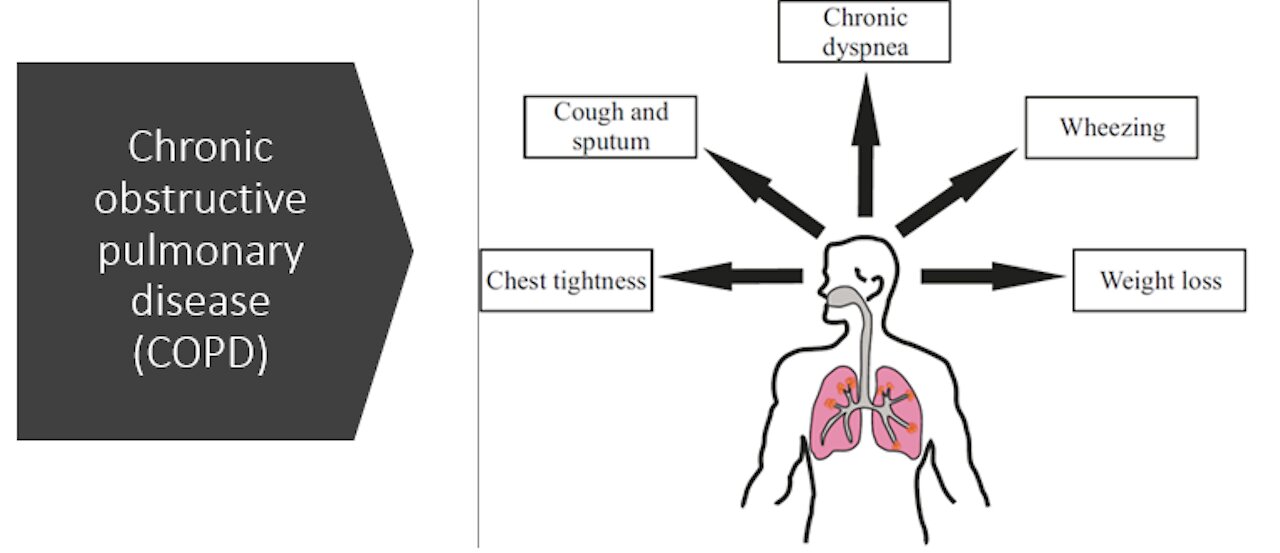 COPD - Chronic Obstructive Pulmonary Disease - Natural Treatment