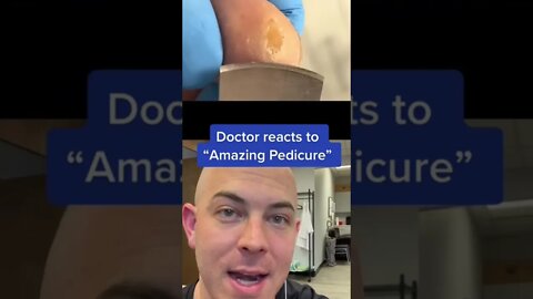 Dermatologist reacts to interesting pedicure! #wart #callus #dermreacts