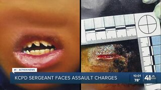 KCPD sergeant charged with assaulting 15-year-old on administrative leave