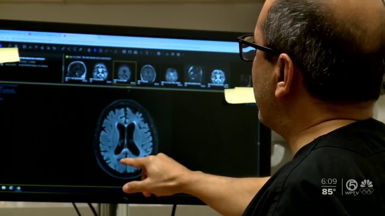 West Palm Beach neurologist reacts to new Alzheimer’s treatment