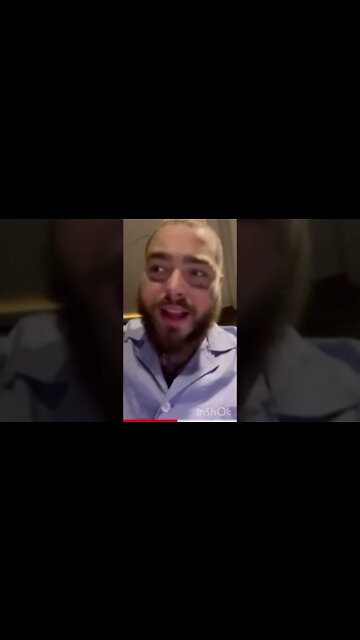 Post Malone Falls and Injured on Stage #shorts #stlouis #postmalone