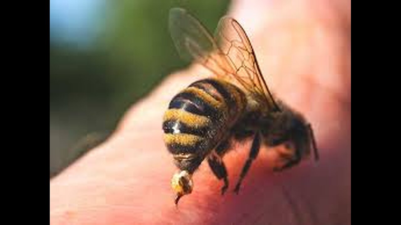 Bee Sting - How to Treat Bee Stings