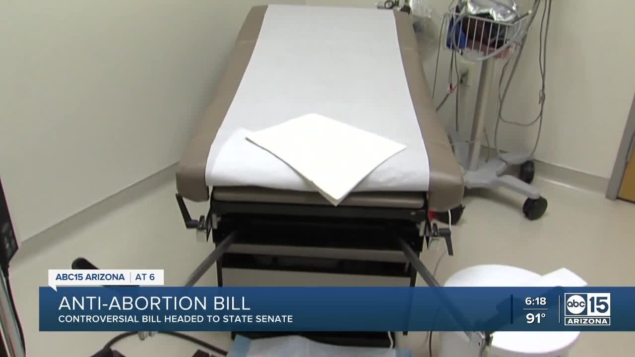 Anti-abortion bill headed to Arizona State Senate