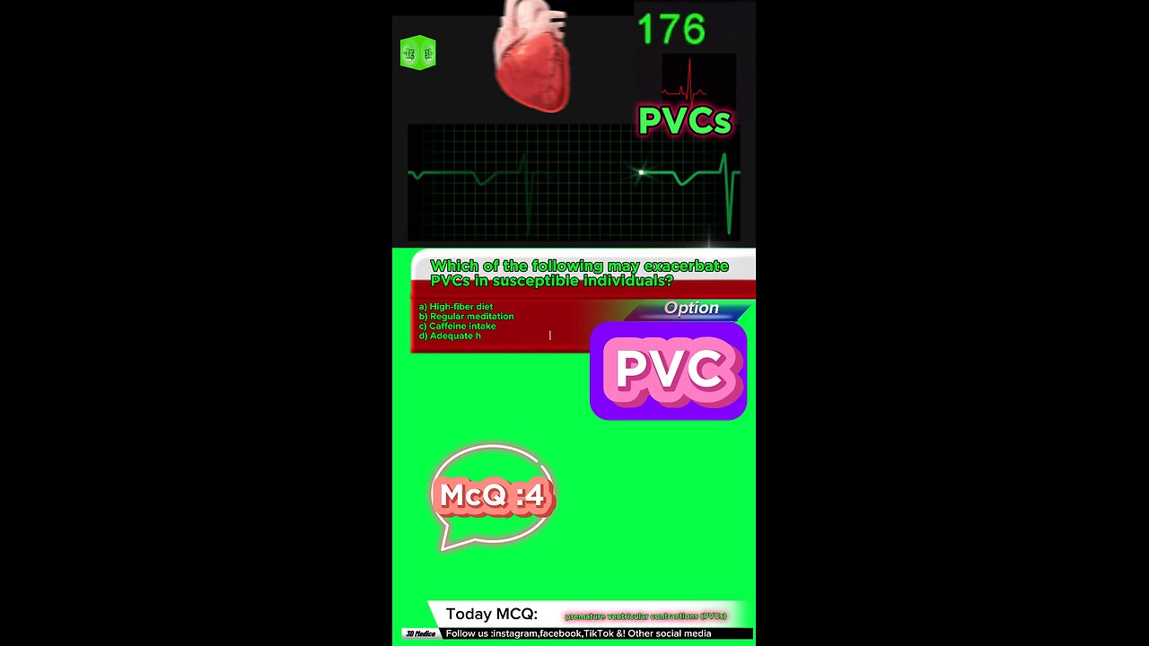 PVC #pvc #arrthymias #cardaic #heart prematureventricle tachycardia