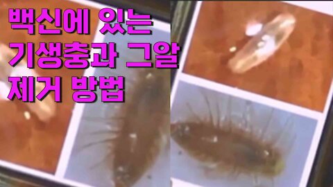 백신에 있는 기생충과 그알 제거 방법