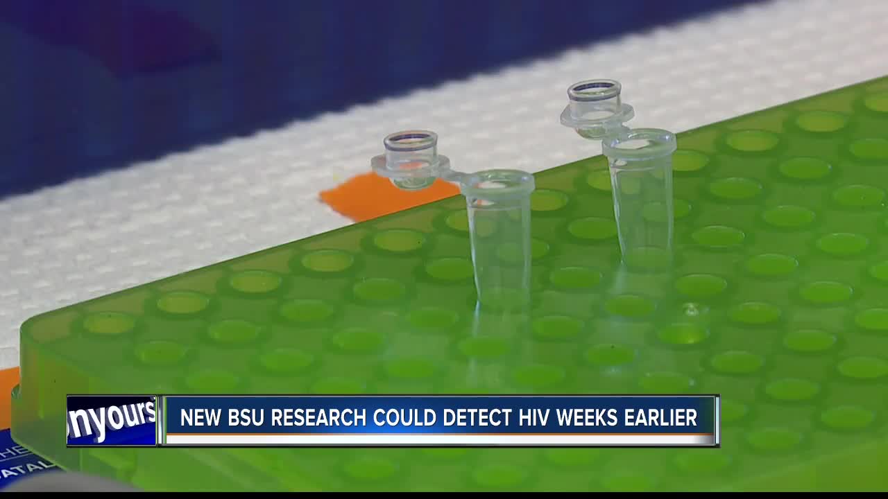 New research at Boise State could detect HIV weeks earlier than standard tests