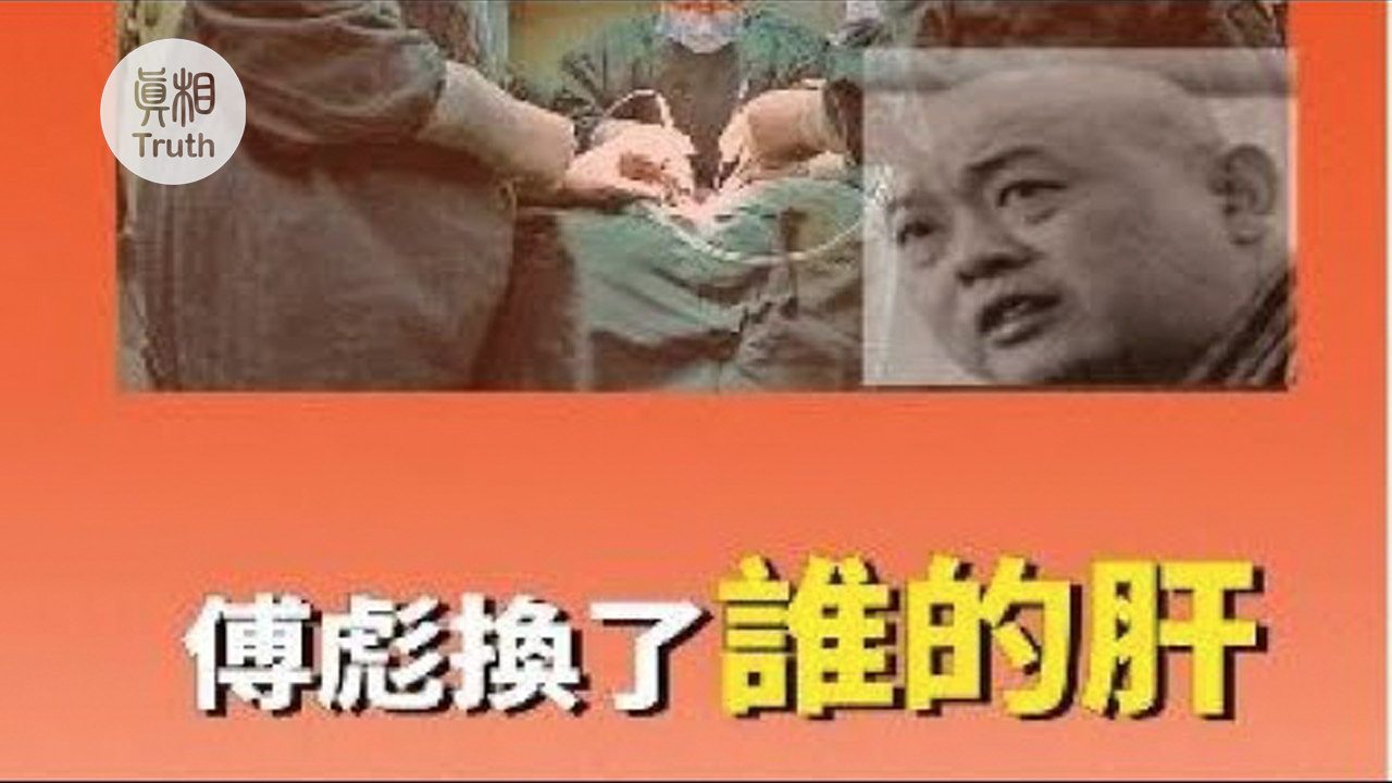 傅彪換了誰的肝?| 真相傳媒